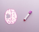 A study links a blood protein to memory and brain changes in Down syndrome