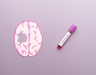 A study links a blood protein to memory and brain changes in Down syndrome