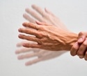 Year-long trial finds NAD-boosting supplement fails to improve early Parkinson's symptoms