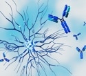Nearly one in three women with autoimmune diseases waited at least four years for a diagnosis, survey finds