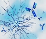 Nearly one in three women with autoimmune diseases waited at least four years for a diagnosis, survey finds