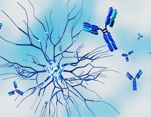 Nearly one in three women with autoimmune diseases waited at least four years for a diagnosis, survey finds