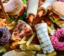 Could ultraprocessed foods affect your brain before you notice?