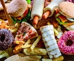 Could ultraprocessed foods affect your brain before you notice?