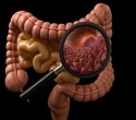 Semaglutide and teduglutide reduce immune-driven gut injury in mice