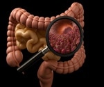 Semaglutide and teduglutide reduce immune-driven gut injury in mice