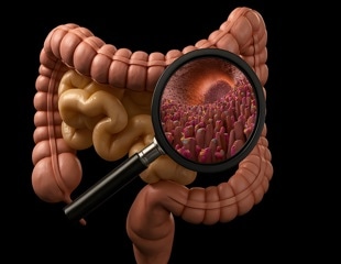 Semaglutide and teduglutide reduce immune-driven gut injury in mice