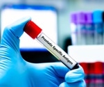 Clues to prostate cancer risk in blood samples taken 15 years earlier