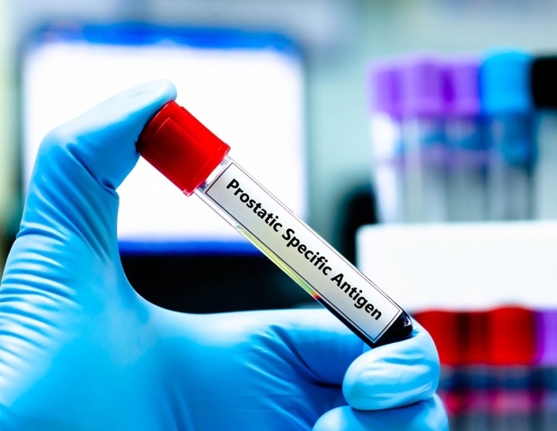 Clues to prostate cancer risk in blood samples taken 15 years earlier