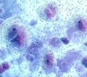 The vaginal microbiome may relate to more than reproductive health