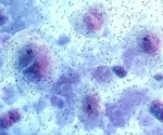 The vaginal microbiome may relate to more than reproductive health