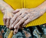 A village beyond Sardinia's blue zone shows striking survival among older women