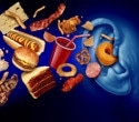 Most adults with obesity did not meet food noise criteria in US survey