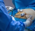 CT scans linked vitamin D levels to fat within muscles after bariatric surgery
