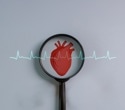 Low vitamin B12 is linked to heart disease. Supplements tell a different story