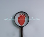 Low vitamin B12 is linked to heart disease. Supplements tell a different story