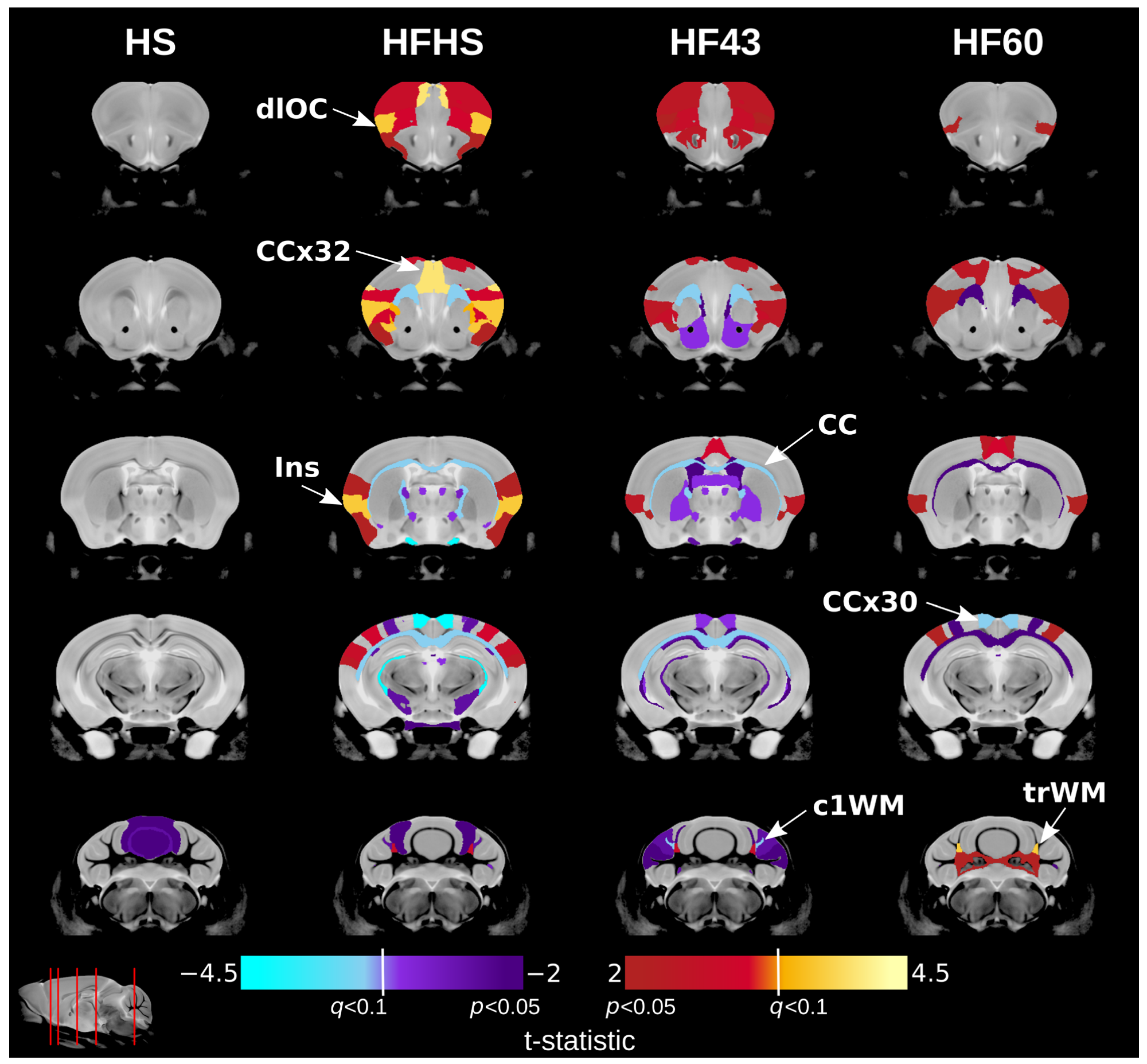 Perinatal diet exposure induces brain structure changes in offspring. Each row shows a coronal cross-section of the offspring brain with the diet groups across the columns. The slice indicator in the bottom left corner shows the location of the coronal slices (red lines). Warm colours indicate structures relatively larger in experimental diet groups and cool colours indicate structures relatively smaller in experimental diet groups as compared to the control diet group. Colours more extreme than the q < 0.1 threshold represent significant structures after correction for multiple comparisons across the diets at 10% FDR. Dark colours below the q < 0.1 threshold represent structures with an uncorrected p-value of less than 0.05. HS diet produces little change in offspring brains by adulthood. The other diets produce neuroanatomical changes with some similarities. dlOC: dorsolateral orbital cortex. CCx32: cingulate cortex area 32. Ins: insular region. CC: corpus callosum. CCx30: cingulate cortex area 30. c1WH: crus 1 white matter. trWM: trunk of simple and crus 1 white matter.