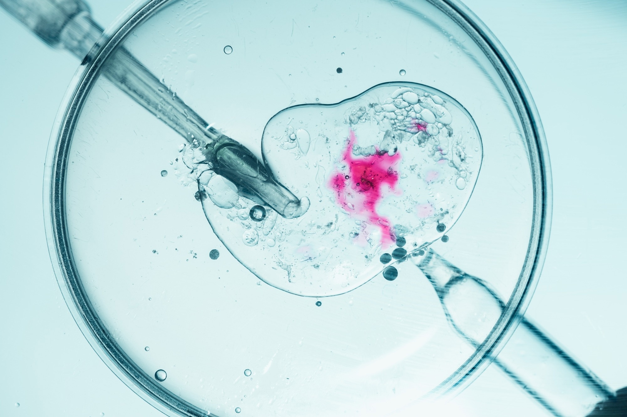 Microscopic view of in vitro fertilization procedure