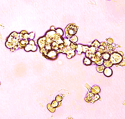 University of Toronto researchers have discovered an ample source of stem cells in an uncharted part of the umbilical cord, providing new hope for bone marrow transplants and tissue repair. Picture - Stem cells under the microscope