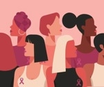 Exercise at home may relieve lymphedema in breast cancer