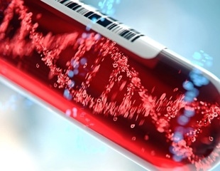 Genomics and AI identify a candidate gene behind rare neurodevelopmental disorder