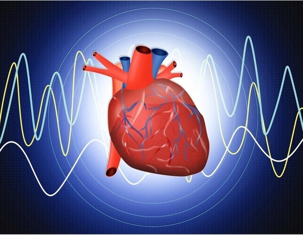 SWITCH SWEDEHEART trial shows prasugrel matches ticagrelor with less bleeding