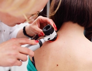 Common human fungus found to worsen melanoma aggressiveness