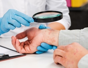 Chronic sunlight exposure disrupts body clocks in skin
