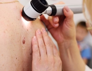 Study reveals a link between genital warts and the human leukocyte antigen system