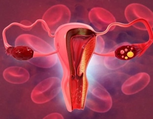 American women show varied preferences for in-clinic versus at-home cervical cancer screening