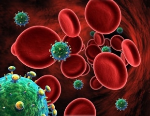 Trauma-related conditions drive deaths in women with HIV