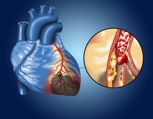 Moderate alcohol consumption linked to premature death and chronic illness