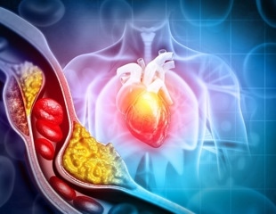 Medicare prescriptions for Wegovy spike after heart disease coverage expansion
