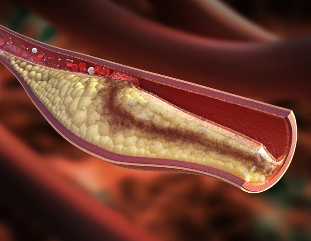 Moderate alcohol consumption linked to premature death and chronic illness