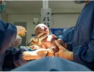 Study reports 10% reduction in overall C-section births in Portugal