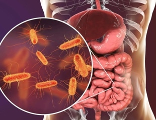 New antibiotic combinations aim to prevent recurrent bacterial vaginosis