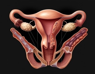 UF professor wins federal grant to develop technology for detecting early-stage endometriosis