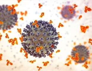 SARS-CoV-2 infection causes specific kidney proximal tubular injury