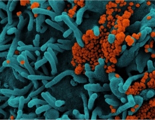 Tiny genetic change influences coronavirus spillover into humans