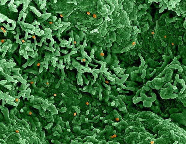 Asymptomatic transmission plays a prominent role in mpox infection patterns