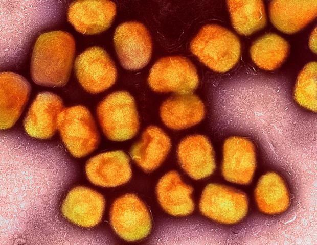 Asymptomatic transmission plays a prominent role in mpox infection patterns