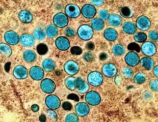 Mpox study reveals high rate of false-positive PCR tests
