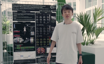 New Ultrasound Methods for Whole-Brain Imaging in Mice