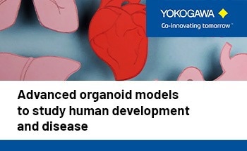 How advanced organoid models are transforming human development and disease research