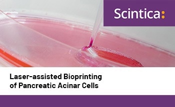 Laser-assisted bioprinting of pancreatic acinar cells