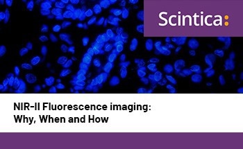 NIR-II Fluorescence imaging: Why, when and how