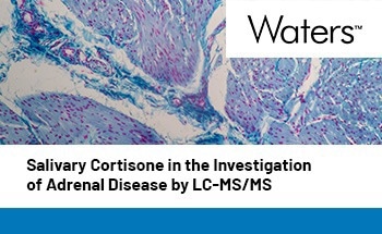 Salivary Cortisone in the Investigation of Adrenal Disease by LC-MS/MS